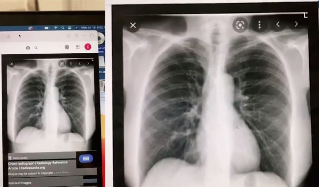 Ovu bolest ima samo JEDAN ODSTO ljudi na svetu: Došla je kod lekara zbog RANICE na prstu, a izašla sa ŠOKANTNOM DIJAGNOZOM