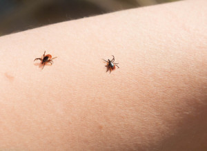 Šta kada na koži nađete KRPELJA? Ovo je siguran način za uklanjanje