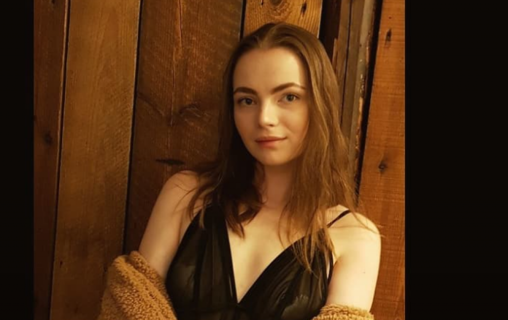 Najviše je strahovala kako će DEČKO reagovati: Ovoj  LEPOTICI je lice potpuno izgorelo u POŽARU i ljudi je se sada PLAŠE (FOTO)