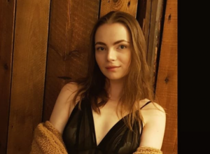 Najviše je strahovala kako će DEČKO reagovati: Ovoj  LEPOTICI je lice potpuno izgorelo u POŽARU i ljudi je se sada PLAŠE (FOTO)