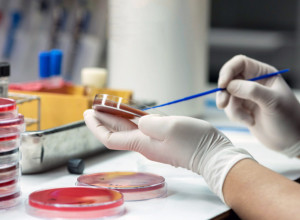 Naizgled bezazleni simptomi slute na OPASNU infekciju: Doktor otkrio kada da obavezno pozovete HITNU pomoć!