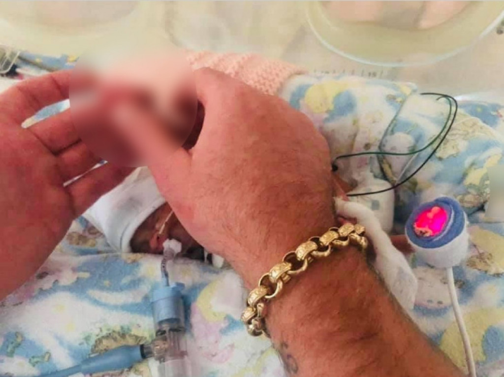 MISLILI SU DA NEĆE PREŽIVETI Beba rođena u 23 nedelji trudnoće, imala je manje od 500 grama, a njena ŠAKA je bila veličine NOKTA njenog oca (FOTO)