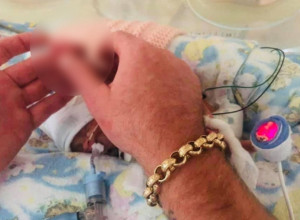 MISLILI SU DA NEĆE PREŽIVETI Beba rođena u 23 nedelji trudnoće, imala je manje od 500 grama, a njena ŠAKA je bila veličine NOKTA njenog oca (FOTO)
