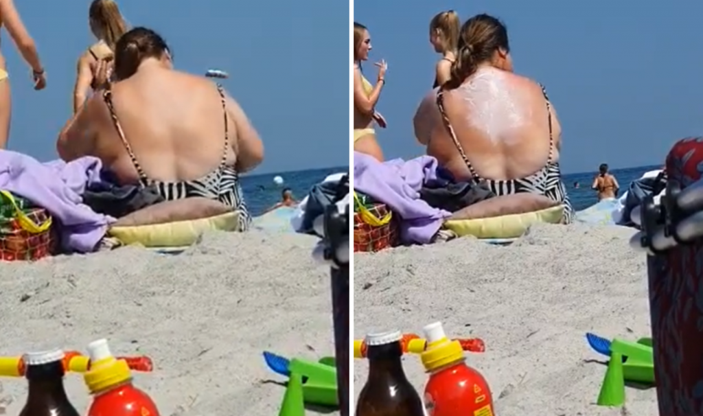 Kakva carica! Žena na plaži u Grčkoj smislila genijalan način kako da sama sebi namaže leđa i sada joj svi moleri zavide (VIDEO)