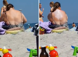 Kakva carica! Žena na plaži u Grčkoj smislila genijalan način kako da sama sebi namaže leđa i sada joj svi moleri zavide (VIDEO)