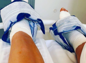Noćna mora, odjednom sam postala INVALID: Poznata POLJSKA atletičarka završila pod nož i sada je u invalidskim kolicima!
