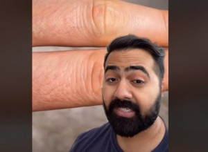 Ovo su TRI GLAVNA SIMPTOMA da ste dehidrirali: Trik koji traje JEDNU SEKUNDU utvrdićete da li vašem organizmu treba tečnosti