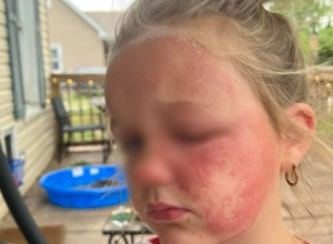 Devojčica (6) umalo UMRLA zbog otrovne biljke: Raste u SRPSKIM dvorištima, izgleda kao BEZOPASAN korov, a ustvari je SMRTONOSNA