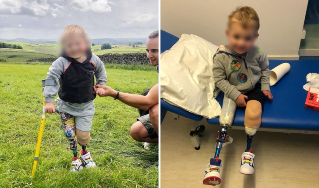 Uzela je SINA iz vrtića i primetila da se NE OSEĆA dobro: Ličilo je na običnu PREHLADU, a onda su mu odsekli OBE NOGE