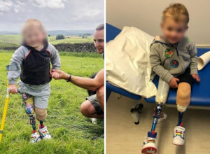 Uzela je SINA iz vrtića i primetila da se NE OSEĆA dobro: Ličilo je na običnu PREHLADU, a onda su mu odsekli OBE NOGE