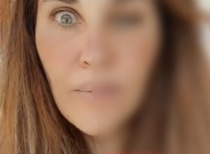 Pokazala je svoje lice posle BOTOKSA: Izgledalo je kao da je preživela MOŽDANI UDAR, deca na ulici su bežala od nje!