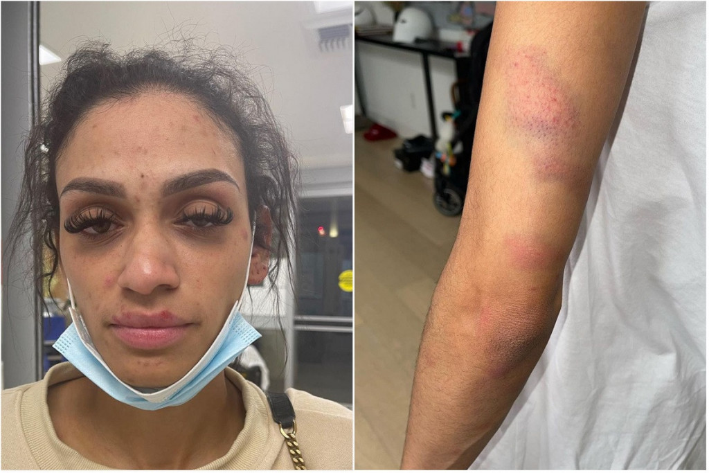 "Ne mogu više da ĆUTIM! Imam frakturu nosa, POTRES mozga, deca su SVEDOČILA": Žena NBA košarkaša optužila muža za NASILJE, iznela je JEZIVE detalje