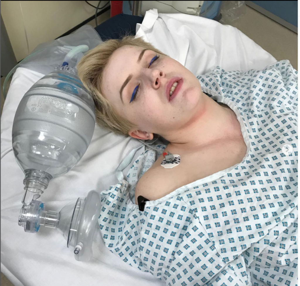 Alergičan na EMOCIJE: Smeh ili tuga mogu da je ubiju - Ja sam kao tempirana bomba koja otkucava