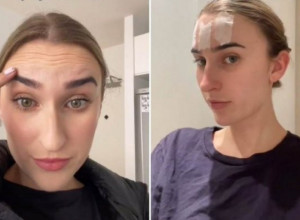 SEDAM dana je spavala sa SELOTEJPOM na čelu: Rezultat je NEVEROVATAN, hirurg otkriva da li stvarno ima EFEKTA