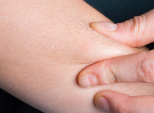 Svaka 10. žena u Srbiji pati od ove AUTOIMUNE BOLESTI: Rani simptomi se mogu videti na KOŽI, ako ih primetite javite se ODMAH lekaru