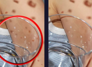 TEST SA ČAŠOM može da spasi život vašem DETETU: Mnogo dece UMIRE od ove opasne INFEKCIJE, ako primetite ovu promenu, odmah se uputite u BOLNICU