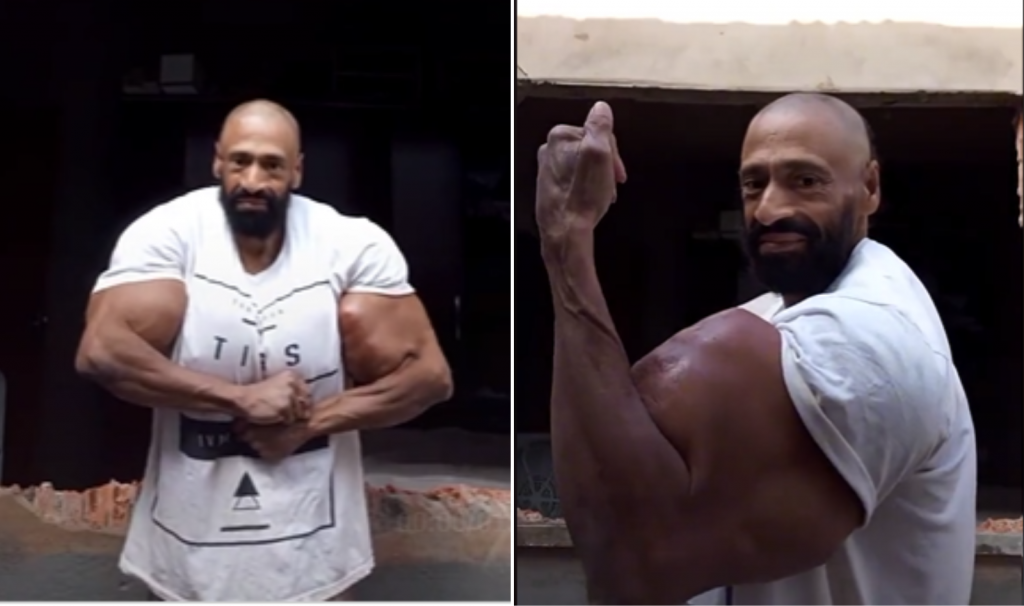 Brazilski HULK je preminuo na JEZIV način: Svoje telo je godinama trovao ovom supstancom, zbog koje se i DEFORMISAO