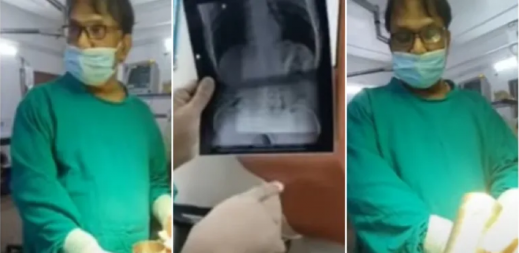 Gojaznim ljudima ovaj deo mozga je uvećan: Skener sve pokazao, ključan je za apetit, a od ove hrane se upali