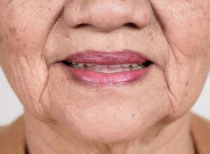 Simptom BOLESTI koji se javlja u USTIMA: Mnogi ne  obraćaju PAŽNJU godinama, a OPASNIJI je nego što možete da ZAMISLITE