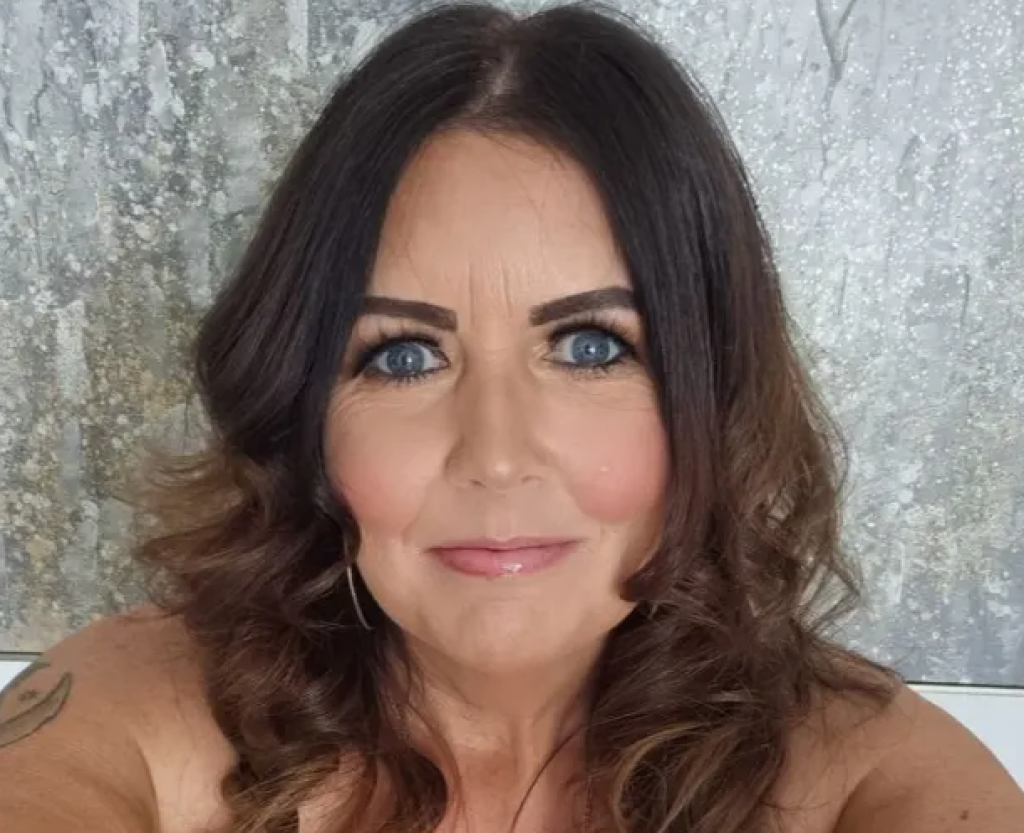 Dobila je DIJAGNOZU smrtonosne bolesti: Šokirana majka (44) kaže da nije imala nijedan MLADEŽ na koži