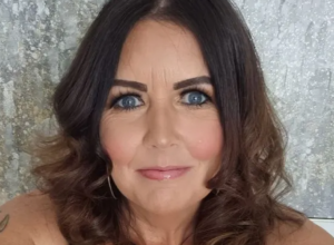 Dobila je DIJAGNOZU smrtonosne bolesti: Šokirana majka (44) kaže da nije imala nijedan MLADEŽ na koži