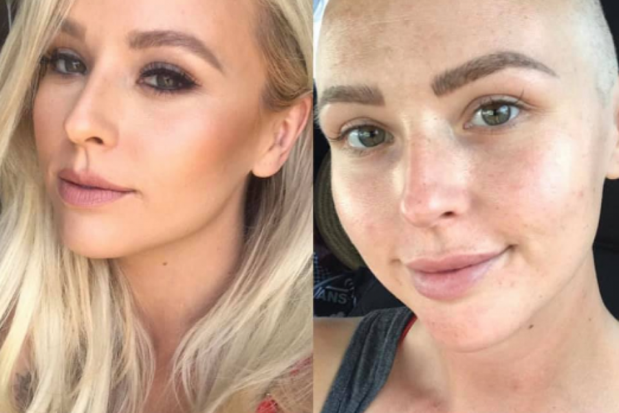 Greška LEKARA je umalo koštala ŽIVOTA: Odbili su da joj urade MAMOGRAFIJU jer je "premlada za rak", ubrzo je čula STRAŠNU dijagnozu!