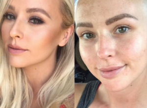 Greška LEKARA je umalo koštala ŽIVOTA: Odbili su da joj urade MAMOGRAFIJU jer je "premlada za rak", ubrzo je čula STRAŠNU dijagnozu!