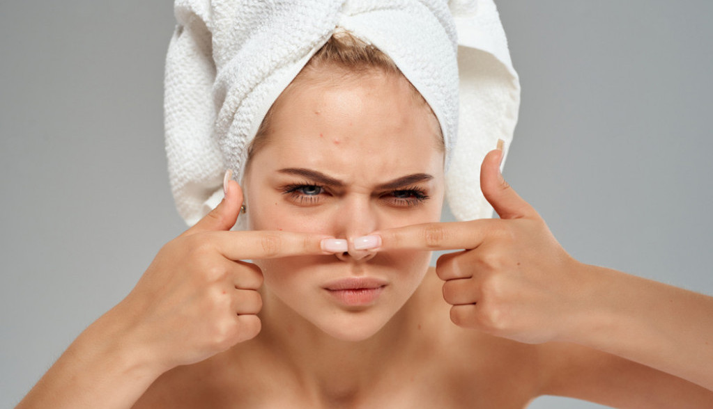 "Možete izgubiti vid": Doktor strogo zabranio ceđenje jedne vrste bubuljice, pa savetovao šta treba da uradimo kada se ona pojavi