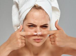 "Možete izgubiti vid": Doktor strogo zabranio ceđenje jedne vrste bubuljice, pa savetovao šta treba da uradimo kada se ona pojavi