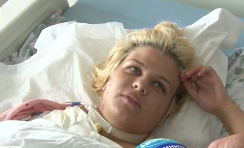 Teodoru je udario GROM i ostavio ožiljke u OBLIKU srca: Danima je bila u KOMI, zbog njenog ISKUSTVA ćete se naježiti
