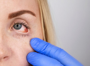 Pogledajte se u ogledalo: Oči kriju simptome 3 opasna zdravstvena problema, otkrijte ih na vreme