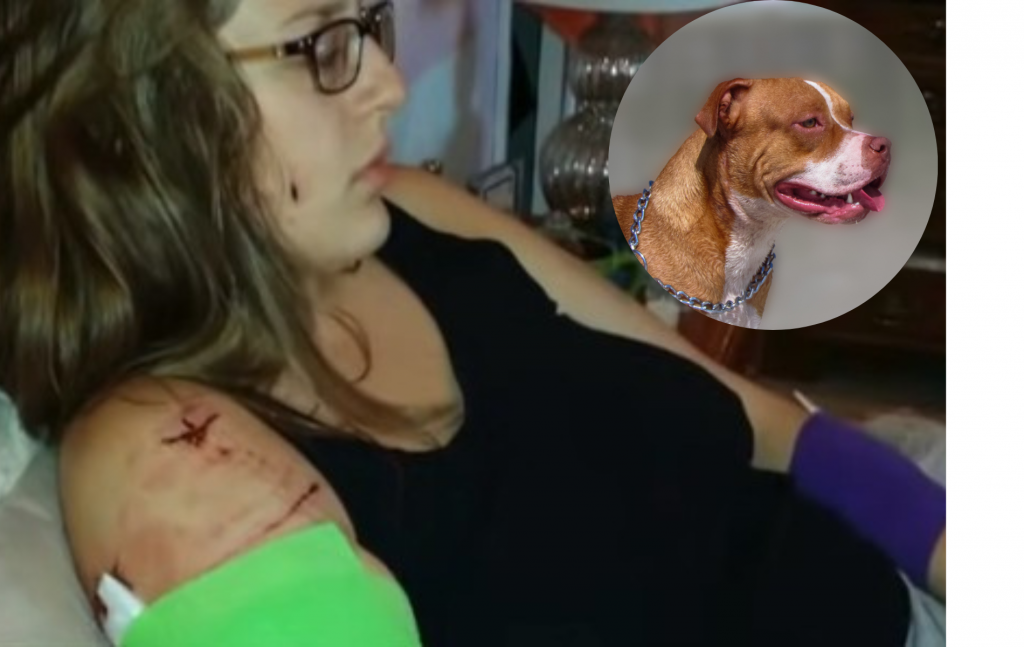 Dve žene su otišle na TRČANJE, pa ih NAPALA četiri PITBULA: Kidali su im MESO i MIŠIĆE, iz pakla ih je IZVUKLA prolaznica, žena HEROJ (VIDEO)