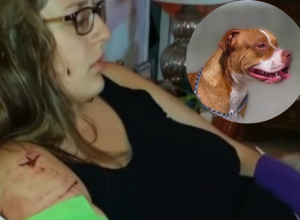 Dve žene su otišle na TRČANJE, pa ih NAPALA četiri PITBULA: Kidali su im MESO i MIŠIĆE, iz pakla ih je IZVUKLA prolaznica, žena HEROJ (VIDEO)