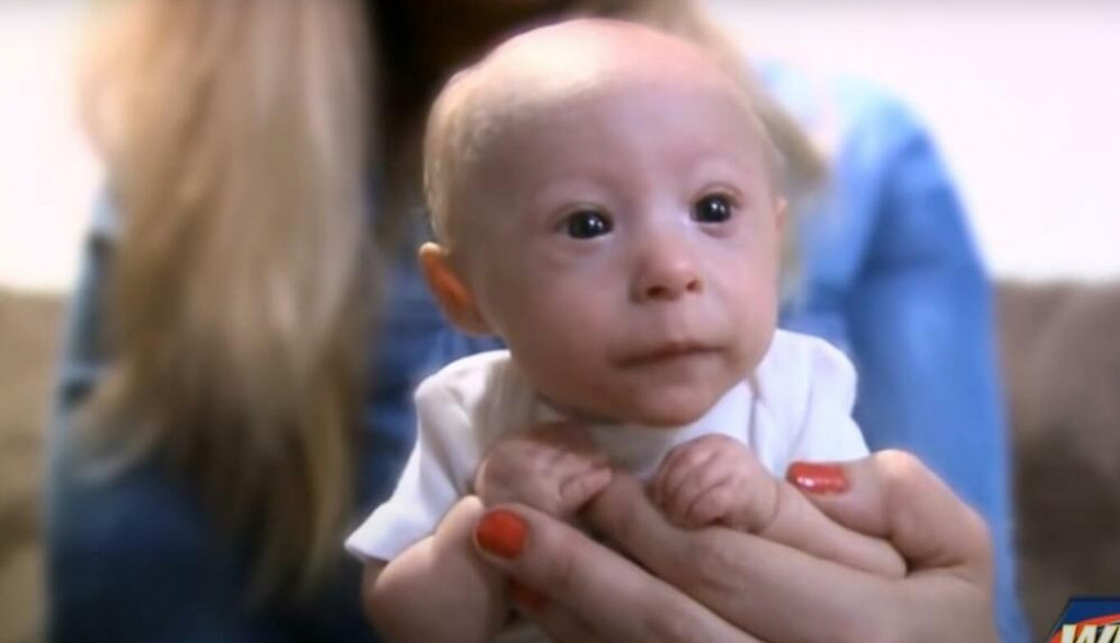 Beba rođena sa MANJE OD POLA KILOGRAMA sada ima 7 meseci: Kada je Matea napunio tri meseca ustanovili su mu PRAVU DIJAGNOZU, a sada nosi odeću za LUTKE