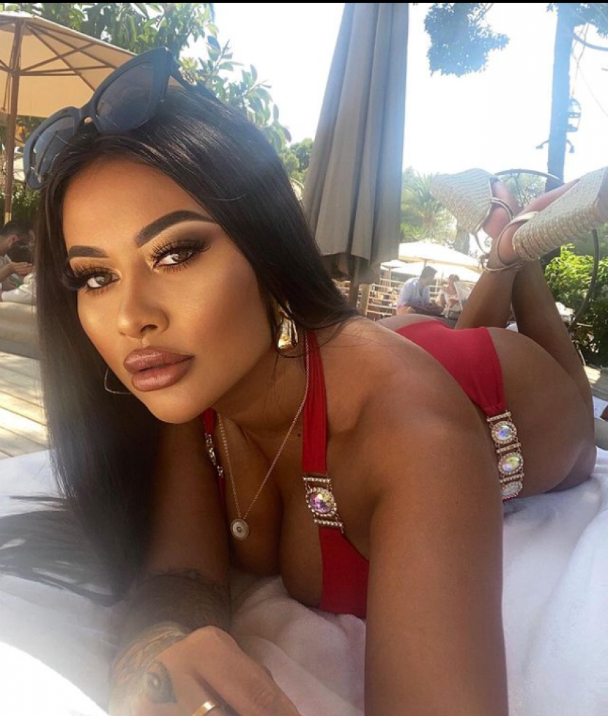 Želela je zadnjicu kao Kim Kardašijan: Danas ne može da nosi farmerke, ali to nije jedini problem!