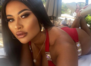 Želela je zadnjicu kao Kim Kardašijan: Danas ne može da nosi farmerke, ali to nije jedini problem!