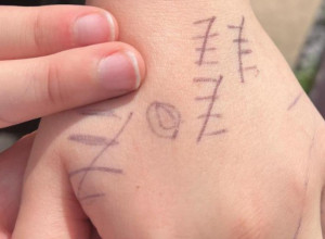 Žvrljotine na dečakovoj ruci kriju BOL i JEZU: Ono kroz šta PROLAZI u školi nikome NE SME da se desi