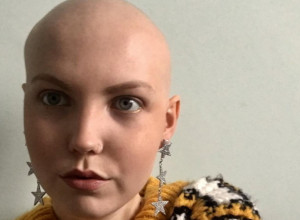 Osećala je UMOR, malaksalost i delovala je BLEDO: Kad je posetila LEKARA, rekli su da joj je ostalo PET GODINA života, evo koja bolest je u pitanju