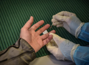 EPIDEMIJA ŽUTICE U HERCEG NOVOM: Inkubacija virusa i do 50 dana