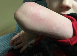 BRNA virus hara vrtićima u Beogradu: Problem je što se zaraza brzo širi, a ovo su simptomi