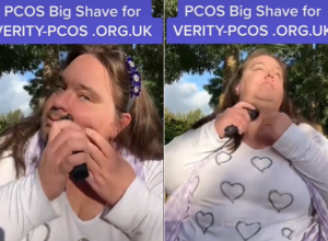 Dva meseca je puštala BRADU kako bi skrenula pažnju na BOLEST sa kojom se bori svaka peta ŽENA (VIDEO)