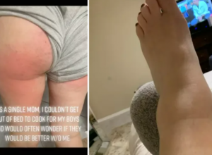 Bolelo je celo TELO i alergije su bile učestale: Ono što su hirurzi videli kada su je otvorili, bilo je ZASTRAŠUJUĆE - "Ovako nešto još nisam video"