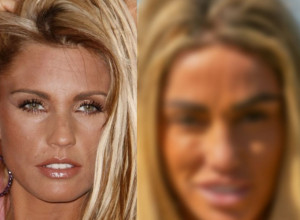 Kejti Prajs pre operacija bila je PRIRODNA LEPOTICA: Zbog njih joj se danas telo RASPADA, mogla je da UMRE na operacionom stolu