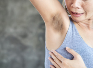 Da li vas nervira tamna koža ispod pazuha? Možete je učiniti svetlijom za samo 10 minuta