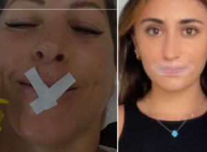 Žene u svetu su POLUDELE za TRIKOM koji je opasan po ZDRAVLJE: Lepe USNE da bi podstakle DISANJE na nos tokom noći