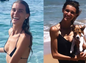 Alkohol je pila da bi zaboravila na glad: Od anoreksije je umalo umrla, ali joj je jedna fotografija spasila život