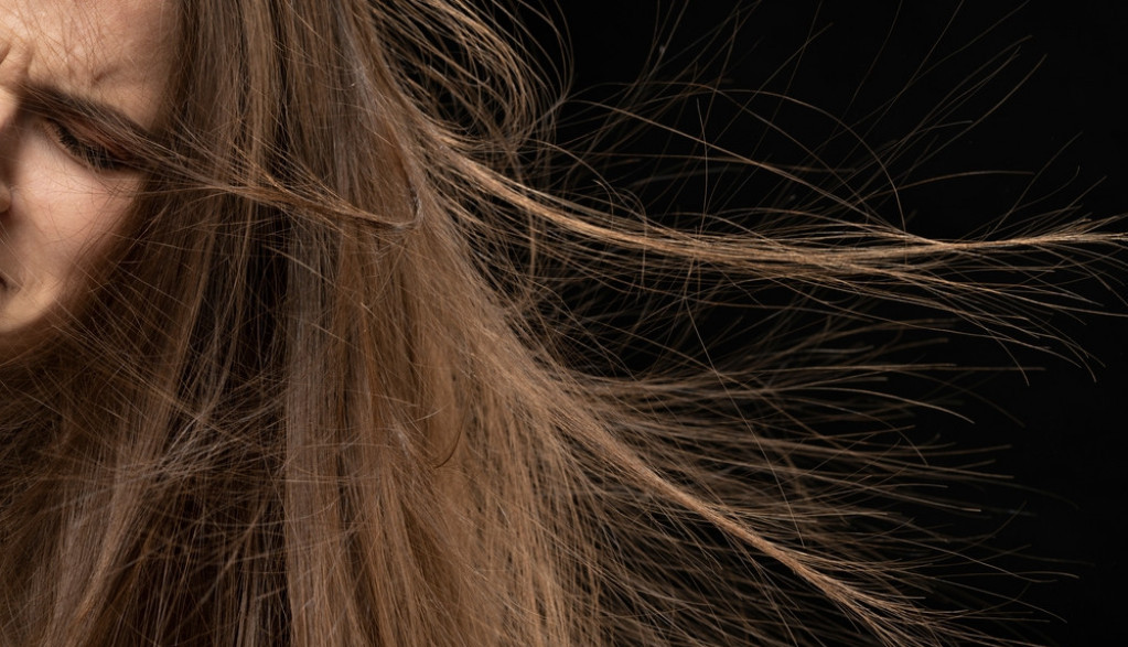 Dlake više neće štrčati na sve strane: Evo kako da naelektrisanu kosu dovedete u red
