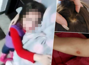 (FOTO) OGLASILA SE MAJKA DECE SA SNIMKA: Baka je optužila da zlostavlja ćerke, EVO KAKO SE ONA BRANI