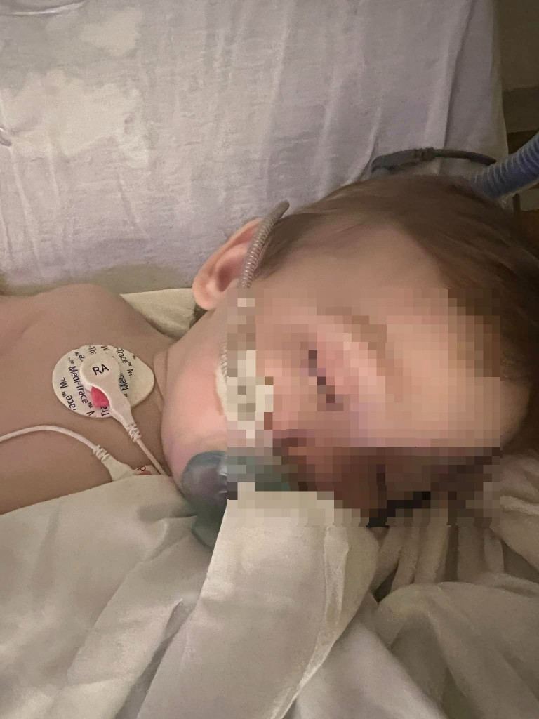 Beba zbog KOMPLIKACIJA završila na RESPIRATORU: Ovaj VIRUS najviše pogađa decu i STARE, a ovi SIMPTOMI se mogu RANO uočiti