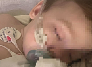 Beba zbog KOMPLIKACIJA završila na RESPIRATORU: Ovaj VIRUS najviše pogađa decu i STARE, a ovi SIMPTOMI se mogu RANO uočiti